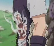 Kabuto Yakushi (Naruto) using Yin Healing Wound Destruction to apply his cell recreation effect on wherever he deems necessary, allowing him to control the location of his regeneration.