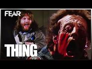 The Blood Test - The Thing (1982)-2