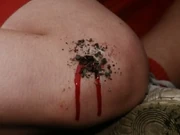 Yukari's bleeding right knee