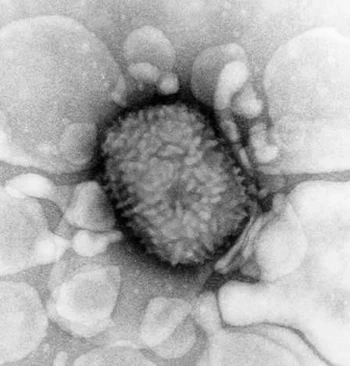 Variola virus | Prehistoric Wiki | Fandom