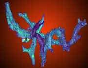 Blood vessels in "Scotty".