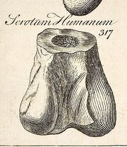 Megalosaurus bone