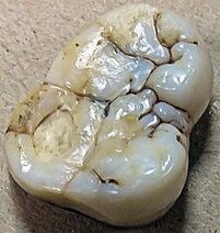 Giganthopithecus blacki, molar