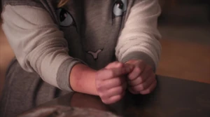 Alison's bruises from the restraints