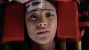 Emily after busting her head