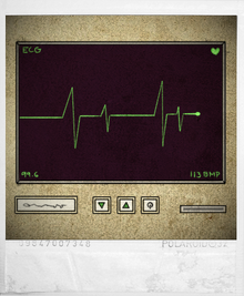 Eeg.png