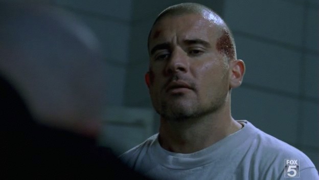 Injuries Prison Break Wiki Fandom