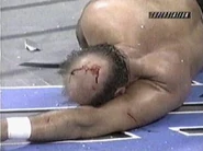Arn Anderson busted open and bleeding.