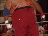 Abdullah the Butcher/Galería de fotos