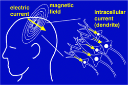 Magnetoencephalography