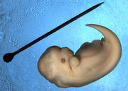 Dolphin embryo