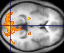 fMRI: Still Not a Mind Reader - Dana Foundation