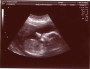 Baby in ultrasound