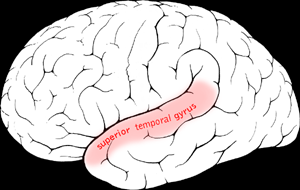 middle temporal sulcus