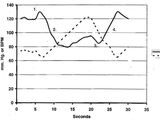 Valsalva maneuver