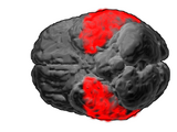 Brodmann area 20