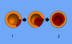 Gastrulation