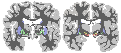 Basal-ganglia-coronal-sections-large