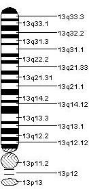 monosomy 13