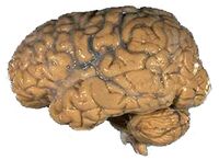 Human brain NIH