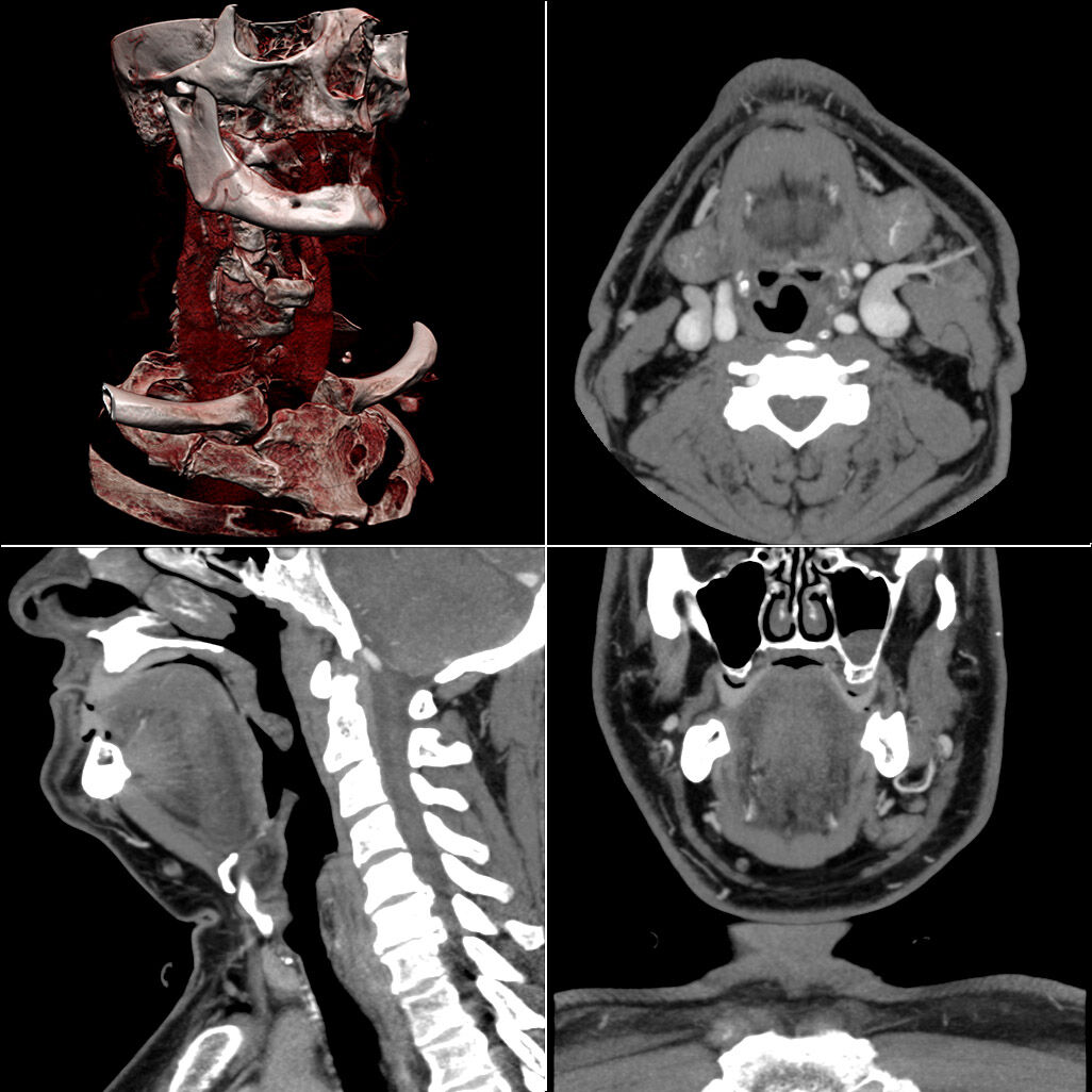 Ct-workstation-neck.jpg