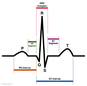 SinusRhythmLabels