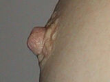 Nipple erection