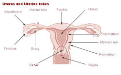 Uterine prolapse - Wikipedia