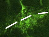 Amacrine cells