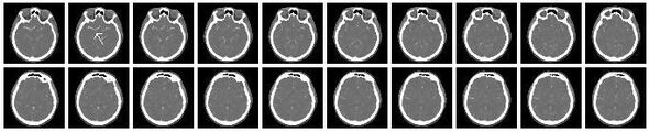 Cranialslices