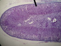 Adrenal gland (cortex)