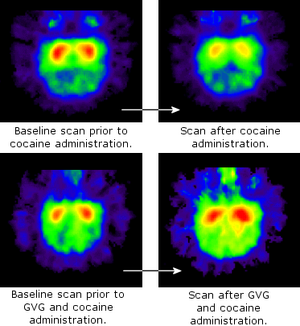 Dopamine monkey