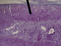 Adrenal gland (zona fasiculata)