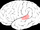 Brodmann area 41