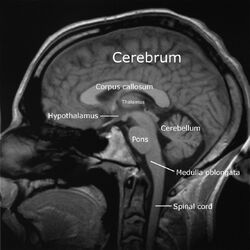 Labeledbrain-english