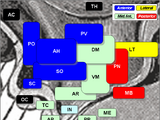 Preoptic area