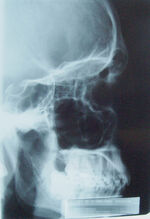X-Ray Skull.jpg