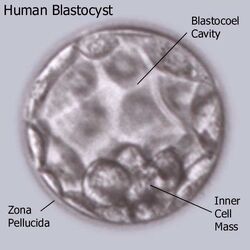 Blastocyst