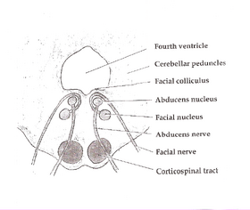 Brainstem Abducens