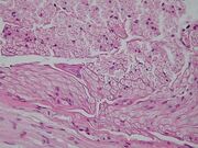 Peripheral nerve, cross section