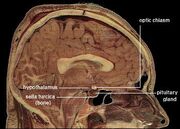 LocationOfHypothalamus