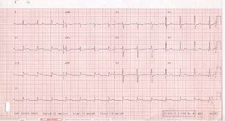 ECG 001