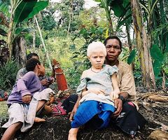 Albinistic girl papua new guinea