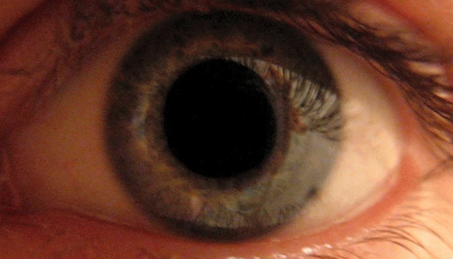 Pupillary Reflex Psychology Wiki Fandom