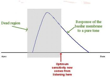 Basilar membrane 2B