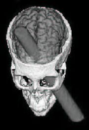 Phineas Gage CGI