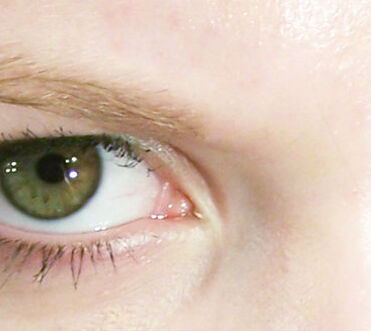 Eye color - Wikipedia