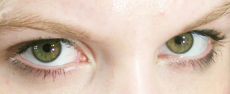 human chimera eyes