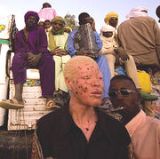 Albino man from niger