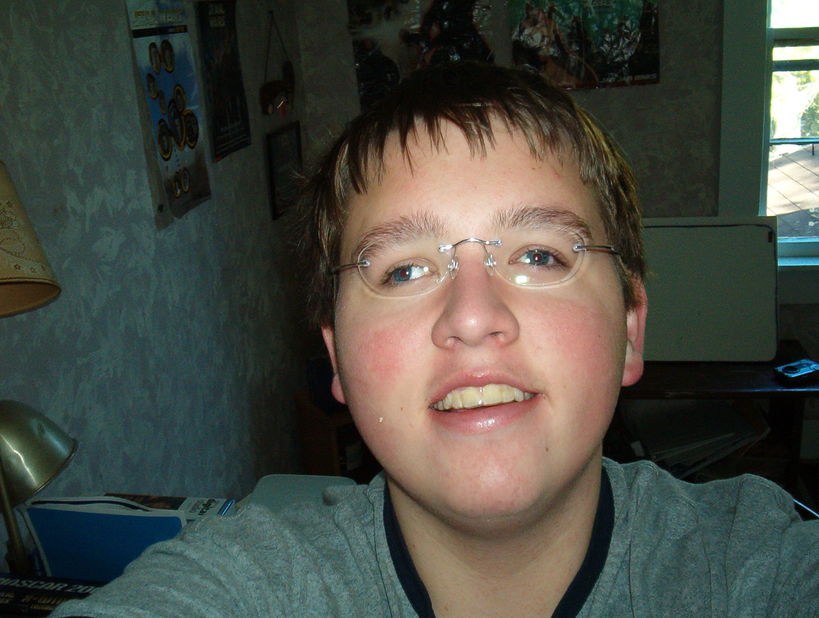 Exotropia Psychology Wiki Fandom Exotropia Psychology Wiki Fandom